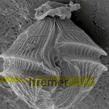 Photo Micro algue IFREMER
